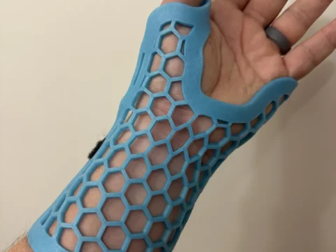 Wrist Splint 3d model